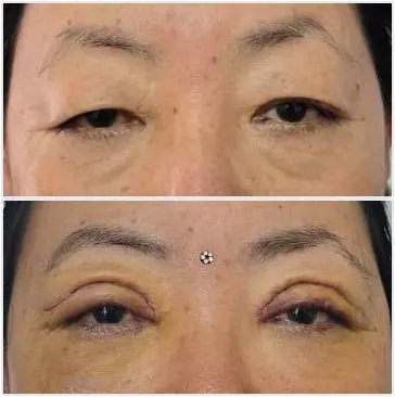 Skin Care Procedure