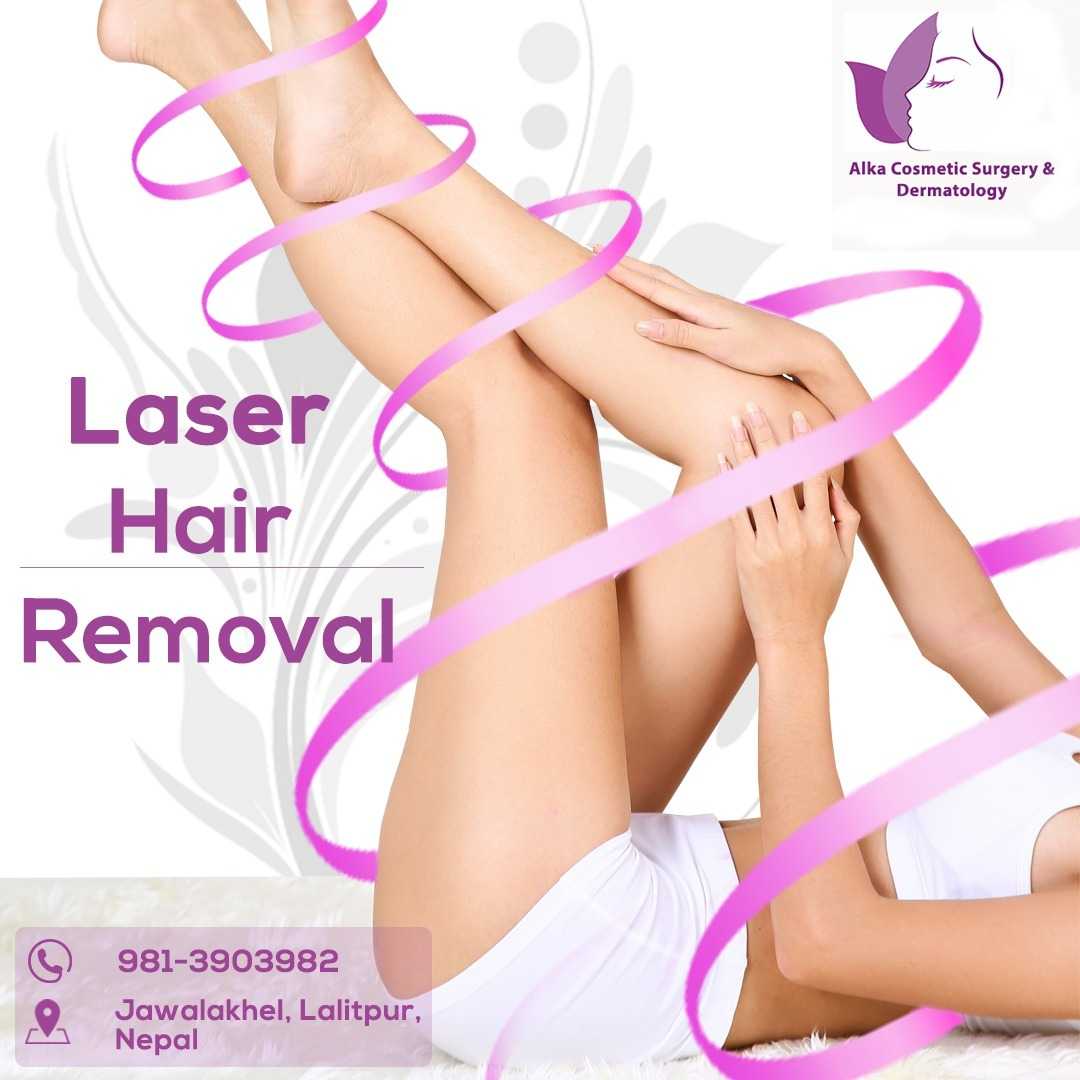 A woman who did laser hair removal. Laser hair removal in nepal