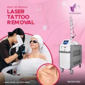 tattoo removal in nepal