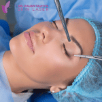 Asian Eyelid Surgery Blepharoplasty in nepal