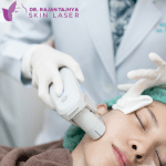 Ultherapy Facelift in nepal